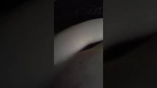 Stomach sloshing