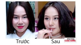 Phong cách & cuộc sống - Bác sĩ Hiệp Lợi tư vấn Phẫu thuật mũi - KM Lại Thanh Hương
