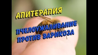 АПИТЕРАПИЯ//ПЧЕЛОУЖАЛИВАНИЕ ПРОТИВ ВАРИКОЗА//деревенские будни