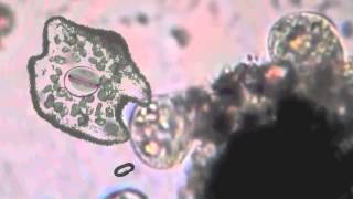 single celled Amoeba