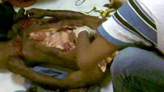 Autopsy
