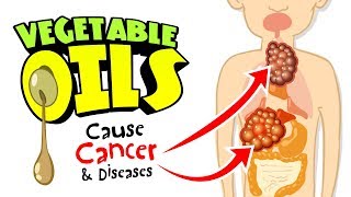 ? Vegetable Oils Cause Cancer, Disease, Body Fat & Inflammation - by Dr Sam Robbins