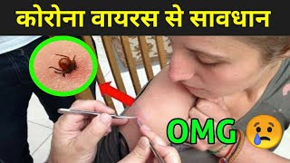 कोरोना वायरस क्या है ? | Coronavirus In India
