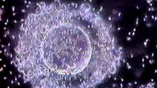 FIV (Fertilización in Vitro)