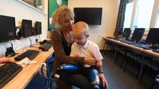 Quadruple amputee aged 5 gets Power Rangers legs