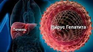 Вирусный гепатит "В" и "С"