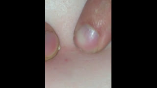 Circle of black heads