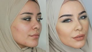 How I Cover Blemishes