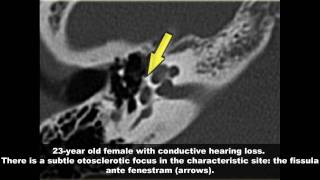 Temporal Bone Radiology Case Review