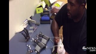 Prosthetic Allows Amputee to Move 'Fingers'