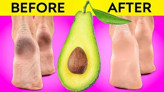 Best Beauty Hacks And Feet Care For You ️