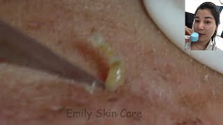 Most Satisfying Video Face Skin Care with Calm Music Ep65