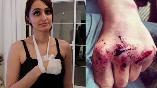 I BROKE MY SISTERS HAND ...