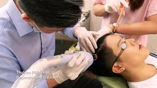 Thulium PDRN Hair Regeneration Treatment