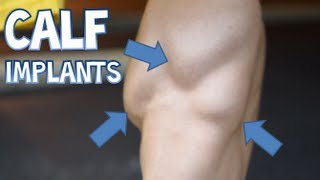 MY CALF IMPLANTS GONE WRONG!