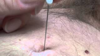 New navel torture with needle - HRES also