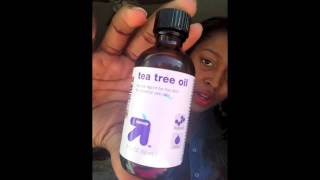 Get rid of your ugly keloids!!! (tea tree oil method Before and after results)