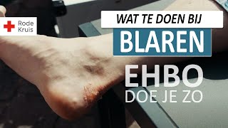 EHBO - Blaar behandelen | Rode Kruis