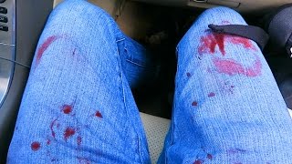 I GOT COVERED IN BLOOD!