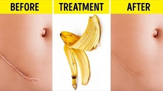 23 UNUSUAL WAYS TO USE EVERYDAY ITEMS