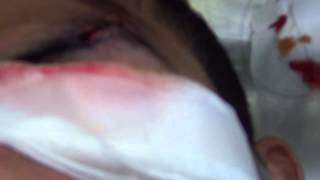 البحرين - المعامير/ إصابات متعددة في صفوف الشباب من سلاح الشوزن المحرم دولياً - من أجلك يابحرين