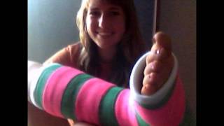 girls in leg cast