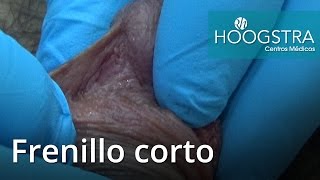 Frenillo corto (16137)
