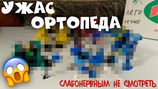 УЖАС ортопеда или дедушки Биониклов - Слайзеры Lego Technic Slizer. Обзор