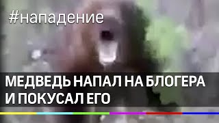 Медведь напал на блогера и покусал его
