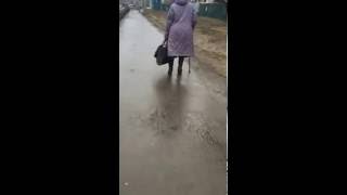 old woman amputee goes to the prosthesis