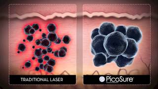 What is PicoSure™?