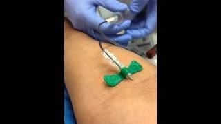 Butterfly needle