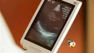 Dr. Eric Topol demos pocket-sized ultrasound - Vscan