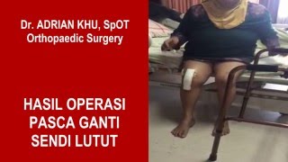 Hasil Operasi Pasca Ganti Sendi Lutut #3