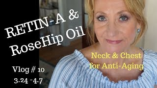 Vlog 10 | Using Retin-A for neck and chest Anti Aging | Mature Beauty | Sixty Plus