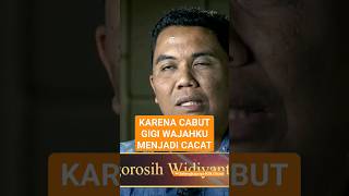 CABUT GIGI MEMBUAT WAJAHKU CACAT | #kisahnyata