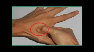 হঠাৎ হাত কিংবা পায়ে ঝি ঝি ধরলে কী করবেন ? মাত্র ১০ সেকেন্ডে এর সহজ সমাধান নিন | Paresthesia