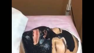 Очистить Лицо От Черных Точек [Удалить Черные Точки На Носу]