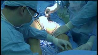 Веновизор Vein Finder VIVO500 S в лечении варикоза. www.darmedical.ru