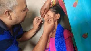 Nandani ka kanchhedan