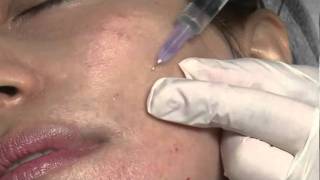 1.10 Jalupro injection techniques EN