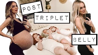 TRIPLET POSTPARTUM BELLY | 3 MONTHS AFTER BIRTH OF TRIPLETS | MY BODY HAS CHANGED