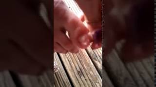 Girl pulls off toenail - gross