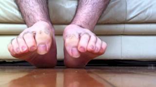 SMELLY TOE WIGGLING DIRTY FEET & LONG TOENAILS