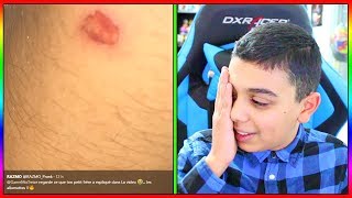 MOMO A BRÛLÉ RAZMO A CAUSE D'UN PRANK - IL NE PENSÉ PAS ETRE ALLER AUSSI LOIN !
