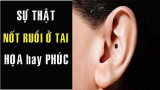 Sự thật nốt ruồi ở TAI là HỌA HAY PHÚC phong thủy nốt ruồi cực chuẩn