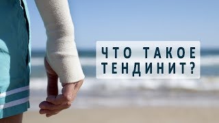 Что нужно знать о тендините (воспалении сухожилий)
