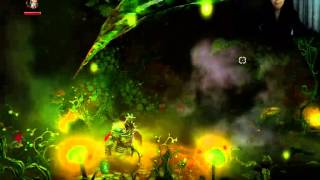 ÇOK FANTASTİK! - Trine 2 - Bölüm 1
