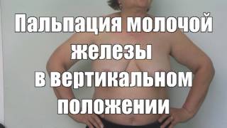 Осмотр и пальпация молочной железы