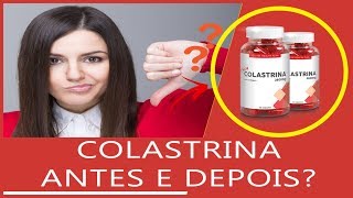 Colastrina Antes e Depois